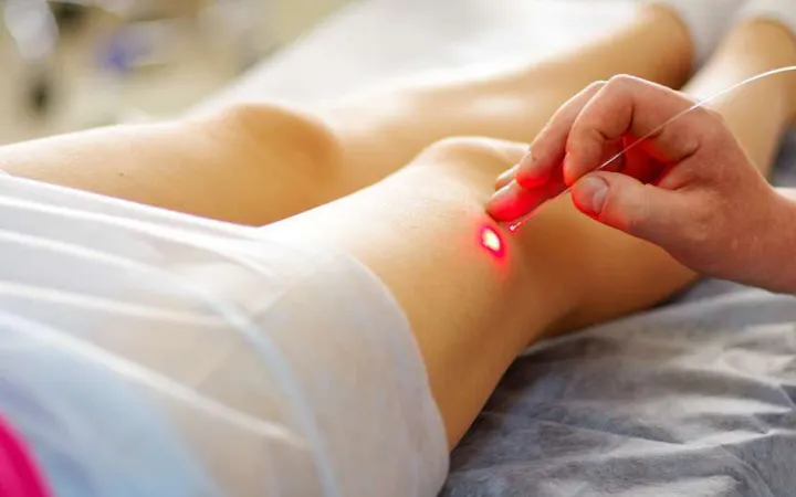 Nurse searching for Varicose Veins in patient